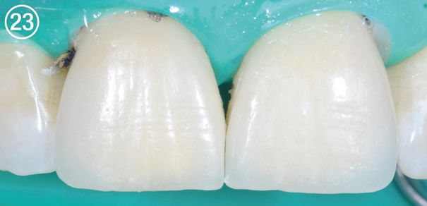 CC 23