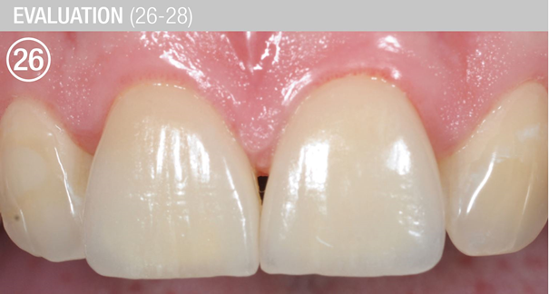 CC 26