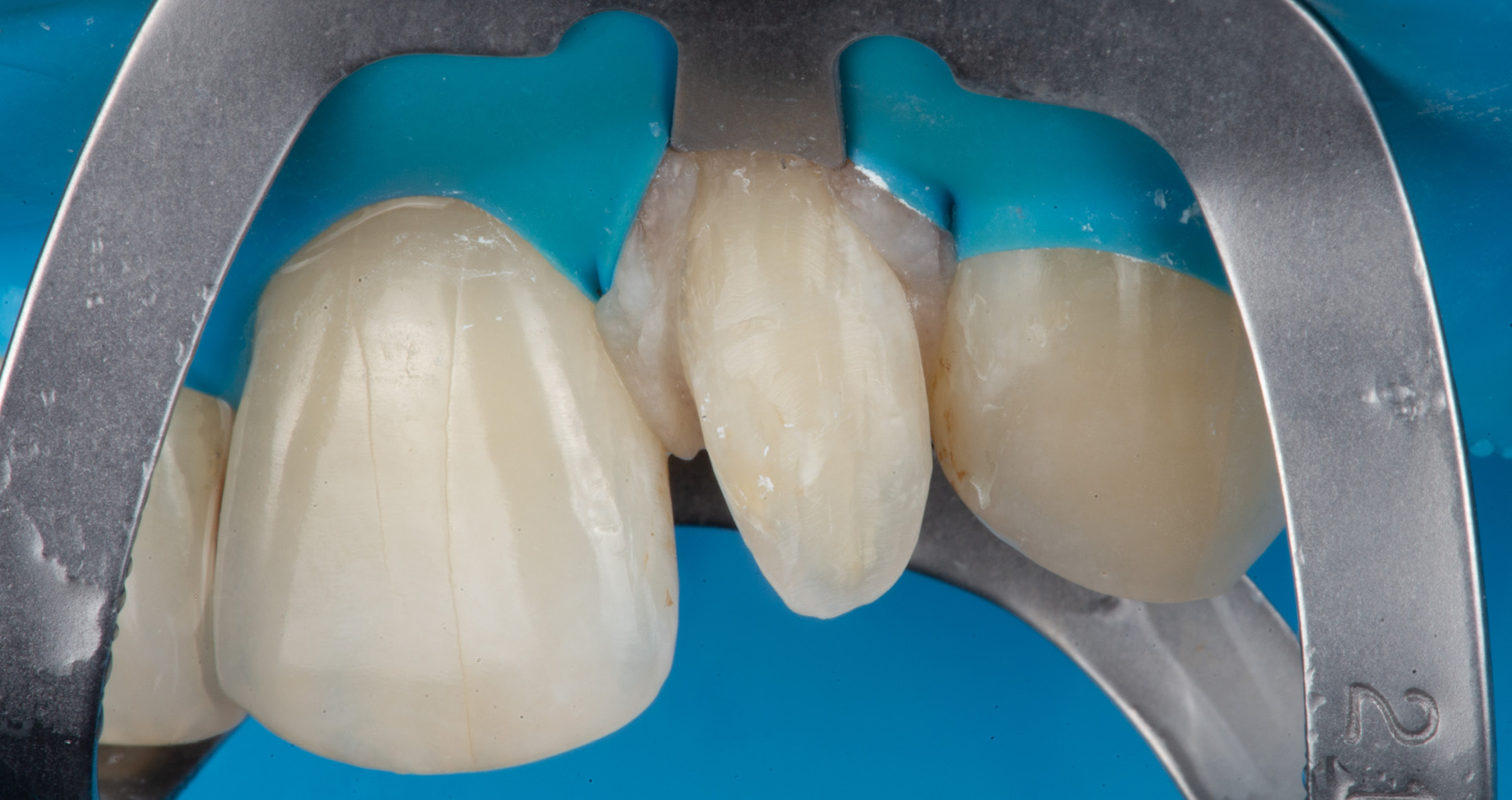 New: KATANA™ Zirconia HTML Plus