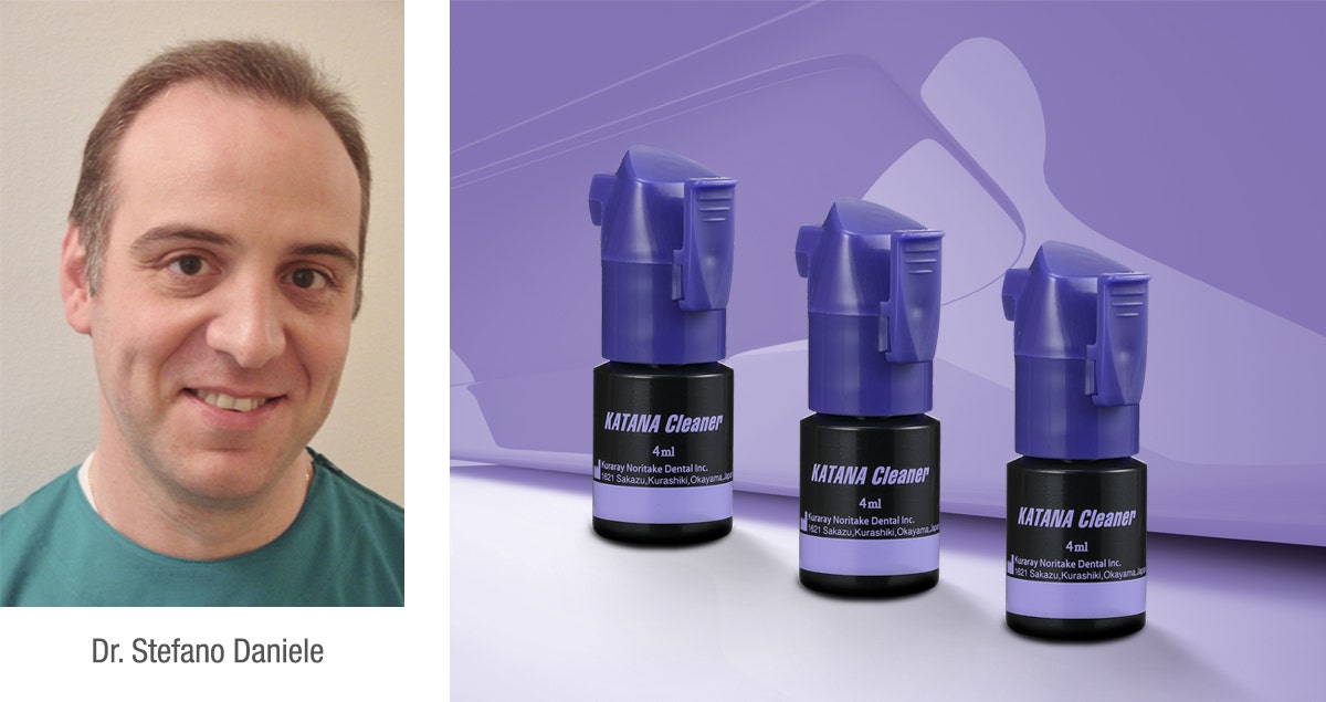 For bonding procedures of metal-free fixed dental prostheses