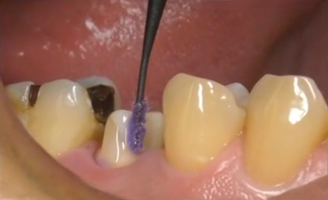 katana cleaner in the mouth